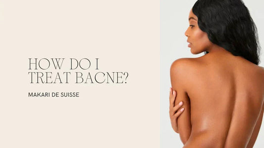 How to Treat Back Acne Bacne in Uganda — Makari De Suisse