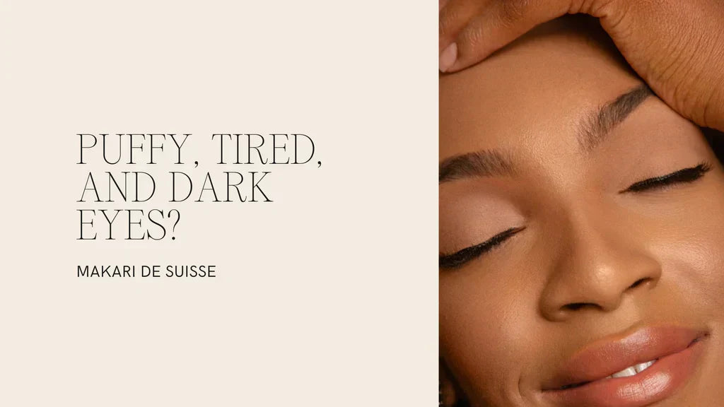 How to Treat Puffy Eyes & Dark Circles in Uganda — Makari De Suisse