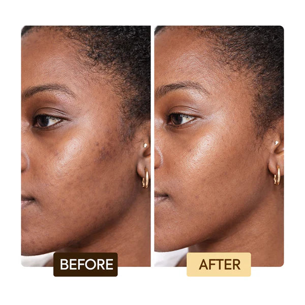 EXCLUSIVE DARK SPOT CORRECTOR SERUM
