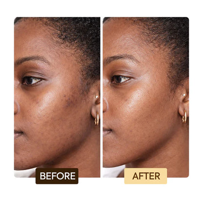 EXCLUSIVE DARK SPOT CORRECTOR SERUM