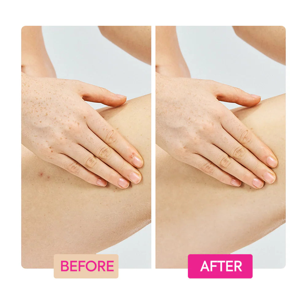 GINGER EXTRACT + TRANEXAMIC ACID + RETINOL BODY TONING CREAM - IYKYK