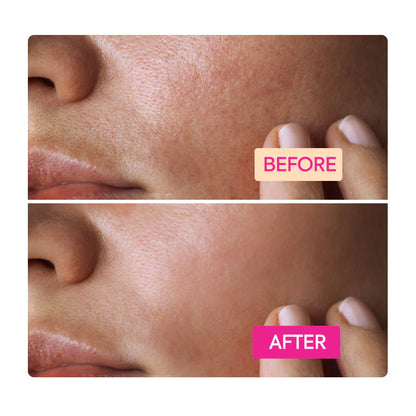 NIACINAMIDE FACIAL BAR SOAP - IYKYK