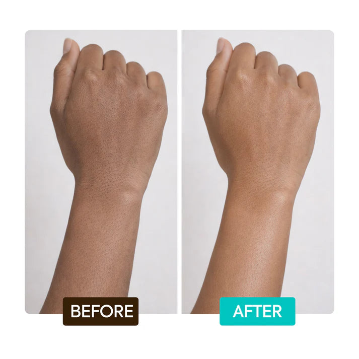 Before After | Makari de Suisse Uganda