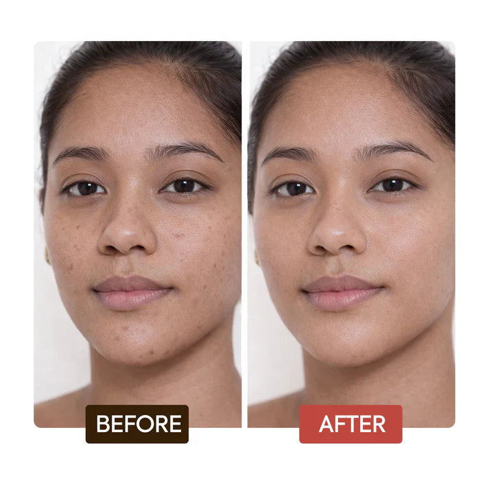 Before and after comparison of a woman's face with visible skin improvement. | Makari de Suisse Uganda