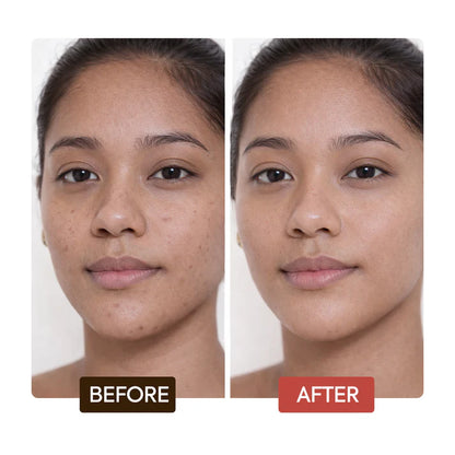 Before and after comparison of a woman's face with visible skin improvement. | Makari de Suisse Uganda