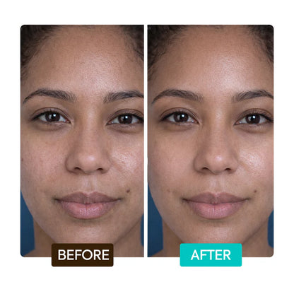 Before and after comparison of a woman's face with visible skin improvement. | Makari de Suisse Uganda