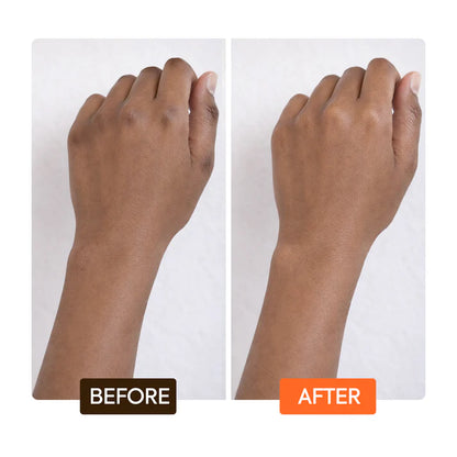 Before and after comparison of a hand with visible dark spots on a white background | Makari de Suisse Uganda