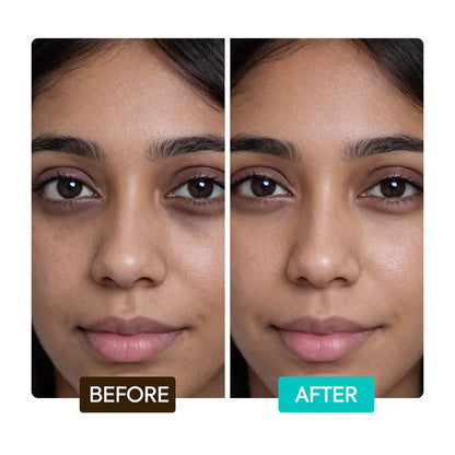 Before and after comparison of a woman's face with 'Before' on the left and 'After' on the right. | Makari de Suisse Uganda