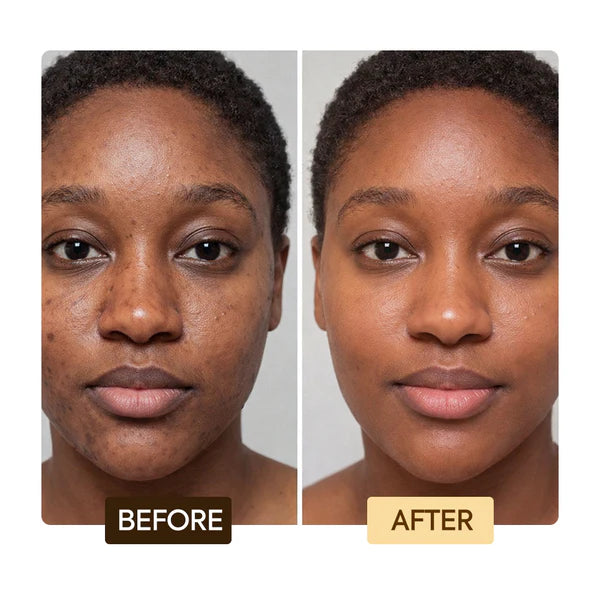 Exclusive Active Intense Soap – Organiclarine Exfoliating Beauty Bar for Even Skin Tone – Makari De Suisse Uganda