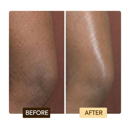 Exclusive Tone Boosting Body Glycerin – Fade Liver Spots & Body Discoloration – Makari De Suisse Uganda