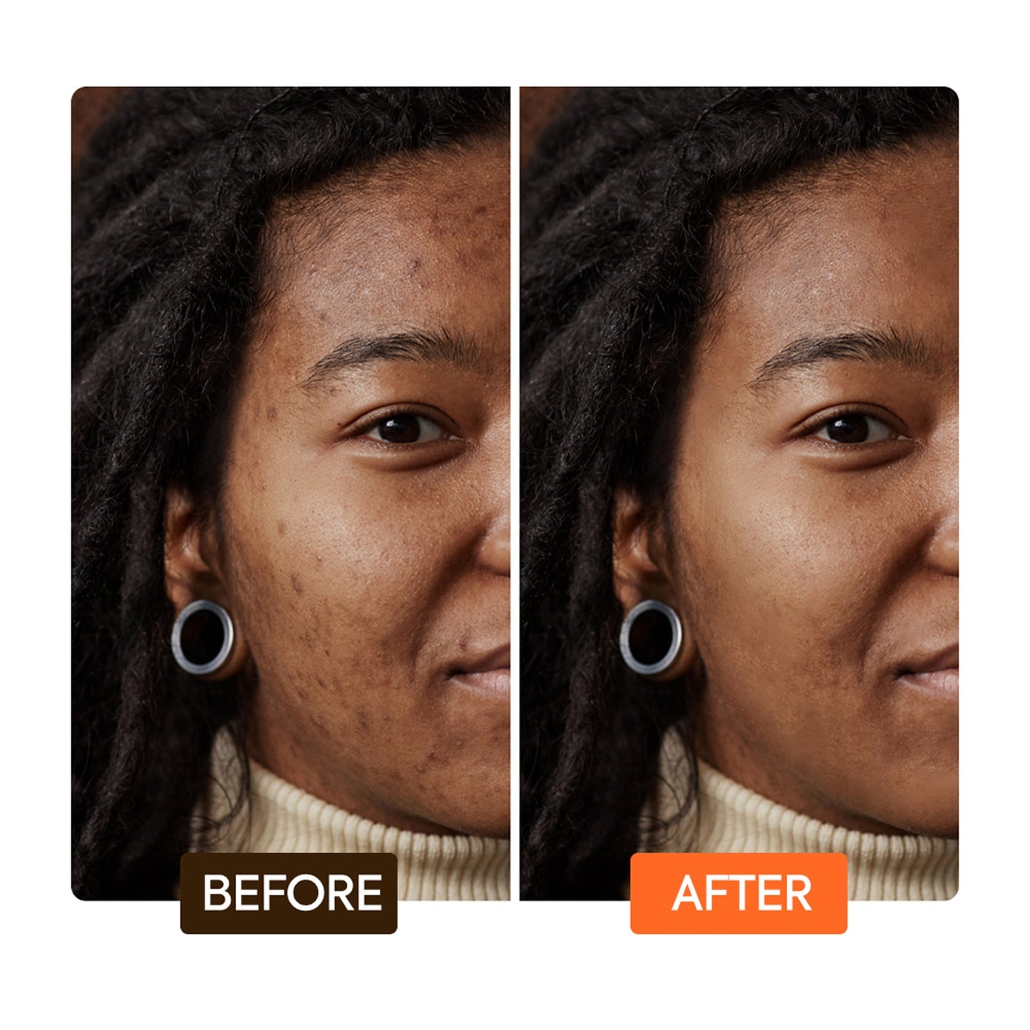 Extreme Argan & Carrot Oil Soap before after | Makari de Suisse Uganda