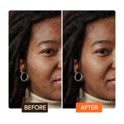 Extreme Argan & Carrot Oil Soap before after | Makari de Suisse Uganda
