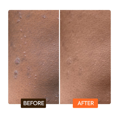 Extreme Argan & Carrot Oil Tone Boosting Body Lotion before after | Makari de Suisse Uganda