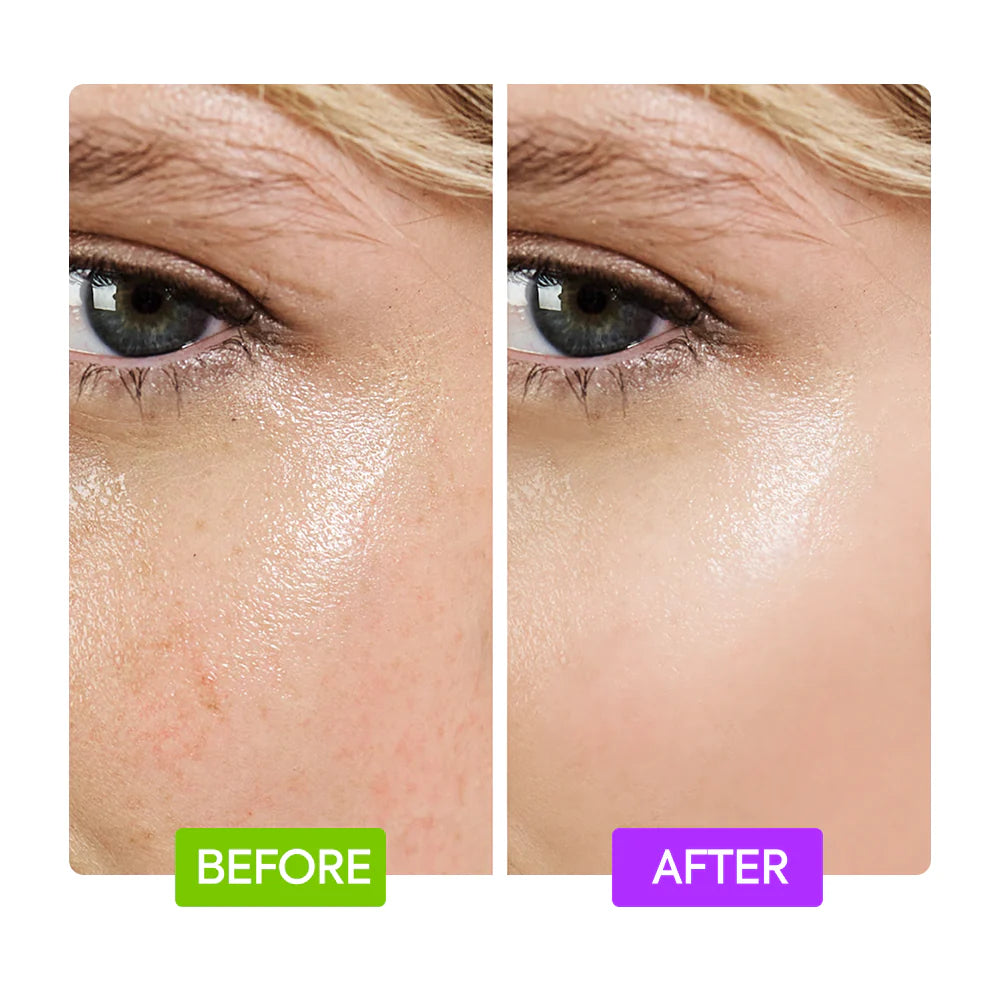 IYKYK 20% AHA + 10% Niacinamide Booster – Chemical Exfoliant for Smooth Bright Even Skin – Makari De Suisse Uganda