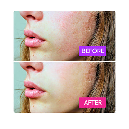 IYKYK Probiotics Booster – Microbiome-Balancing Serum for Calm Clear Skin – Makari De Suisse Uganda