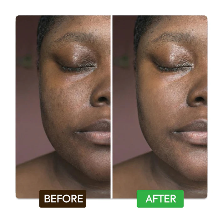 Kojic & Azelaic Brightening Serum – Fade Dark Spots & Even Skin Tone – Makari De Suisse Uganda