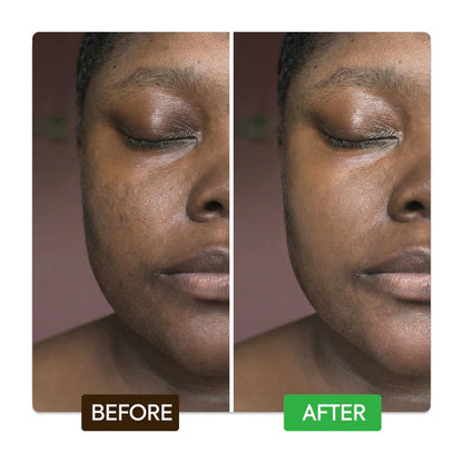Kojic & Azelaic Brightening Serum – Fade Dark Spots & Even Skin Tone – Makari De Suisse Uganda