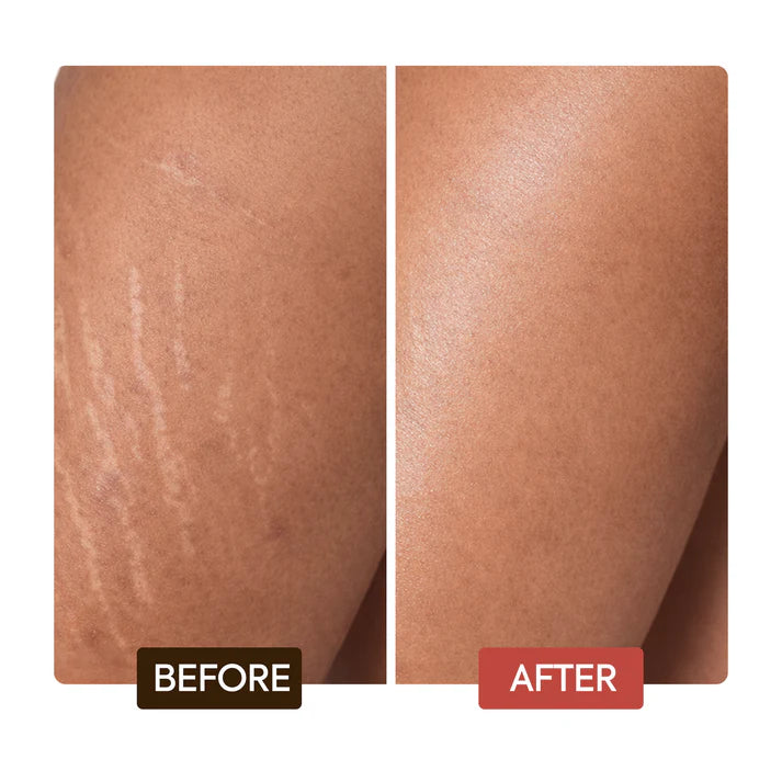 Naturalle Intense Extreme Glow Body Lotion – Shea Butter for Stretch Marks & Radiance – Makari De Suisse Uganda